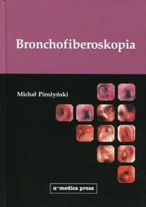 Bild von Bronchofiberoskopia