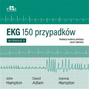 Obrazek EKG 150 przypadków