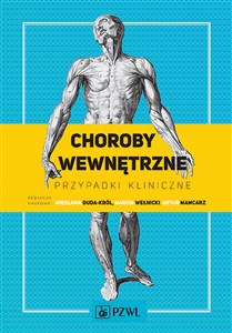 Bild von Choroby wewnętrzne Przypadki kliniczne
