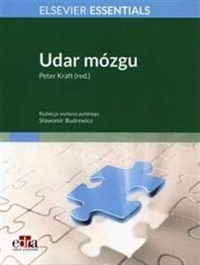 Obrazek Udar mózgu