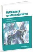 Osteoporoz... - Wojciech Pluskiewicz - buch auf polnisch 