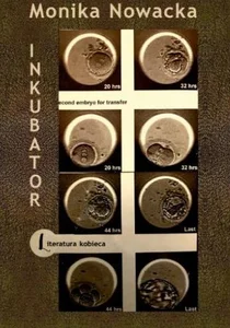 Obrazek Inkubator