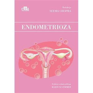 Obrazek Endometrioza